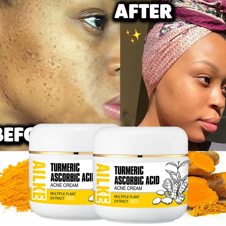 Hydro Turmeric Whitening Herbal Cleansing Private Label Facial Creams Moisturizing Acne Treatment Moisturizer Face Cream