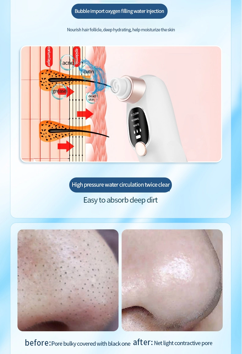 Facial Skin Care Pore Cleaner Blackhead Remover Vacuum