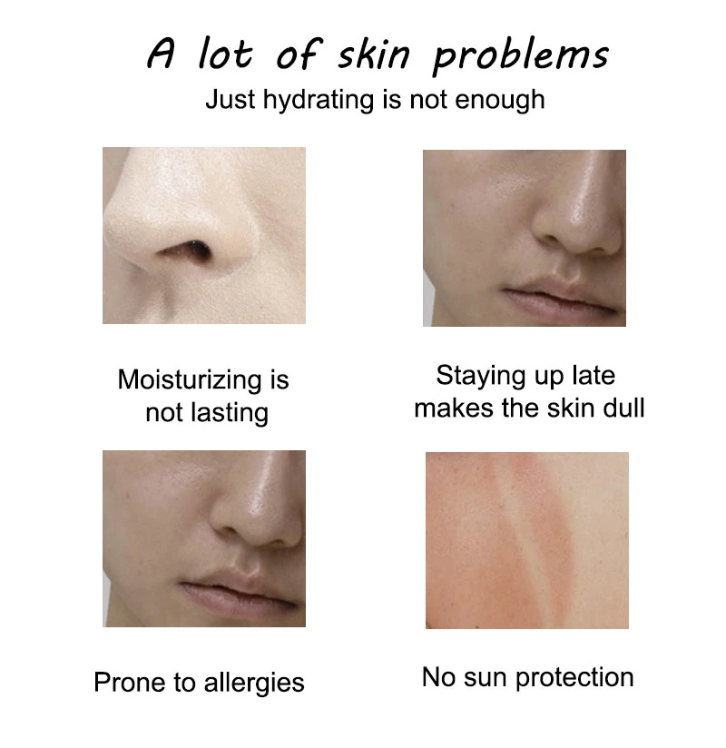 Beauty Cosmetics Skin Care Moisturizing Soothing Skin Anti Acne Chamomile Face Toner
