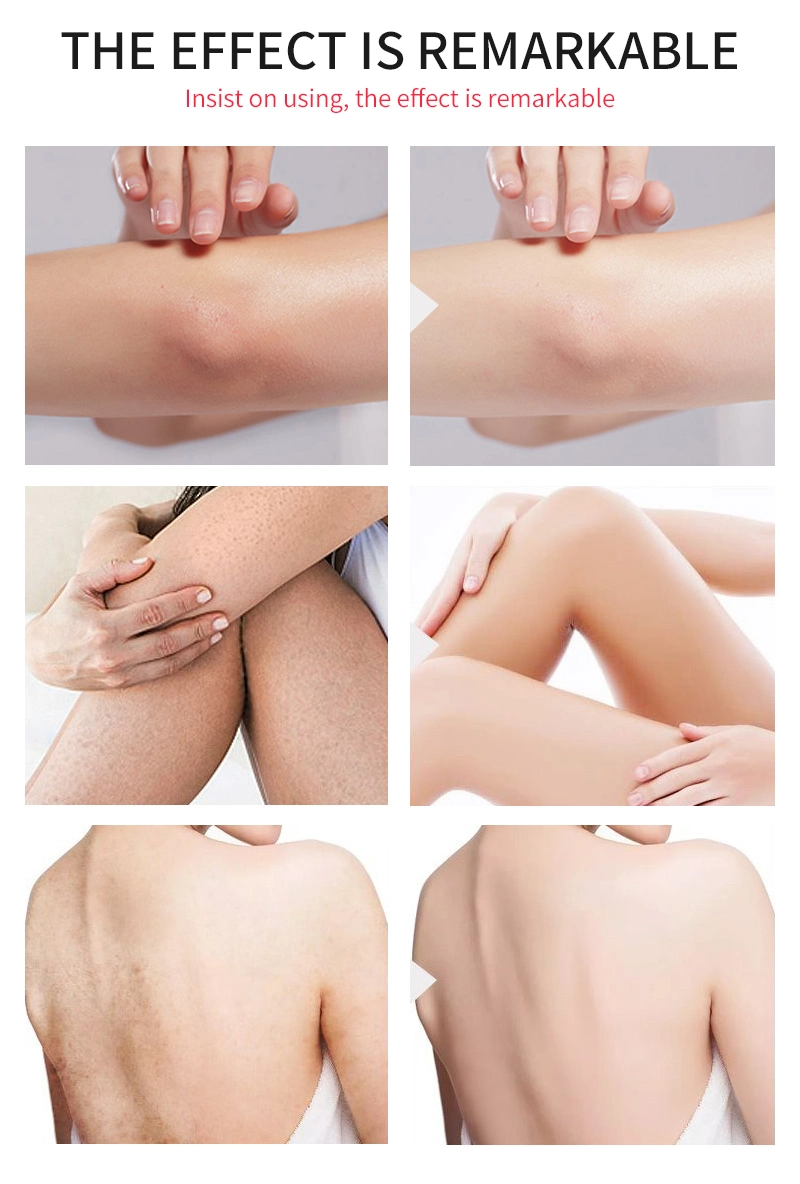 Customized Lightening Cream Instant Kojic Acid Skin Whitening Body Lotion