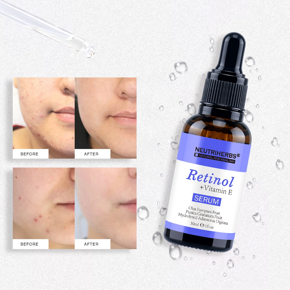 Private Label Deep Moisturizing Anti-Aging Acne Retinol Serum