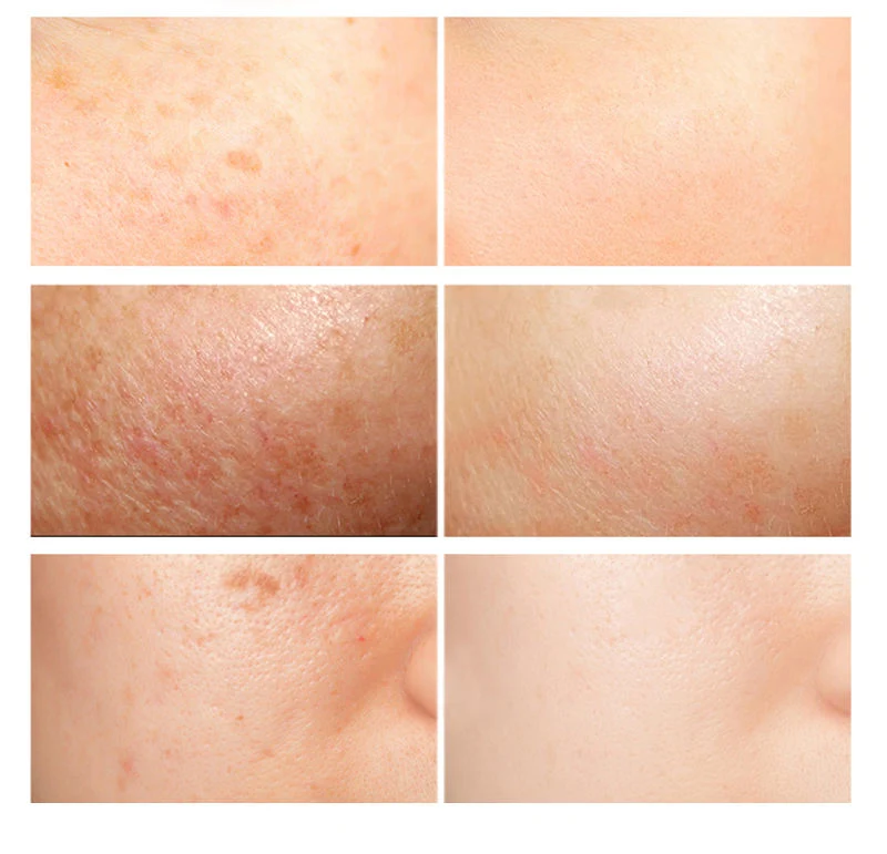 Glutathione Whitening Skin Whitening Glow Face Rose Gold Serum Ze-Light