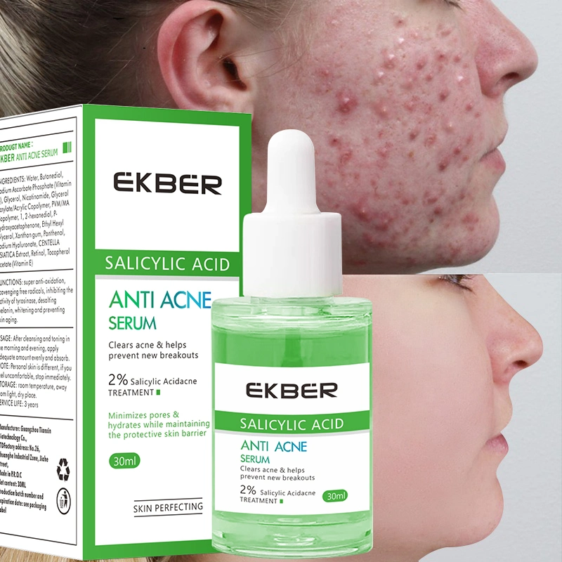 Private Label Organic Facial Skin Care Acne Spots Clearing Skin Soothing Scar Fading Anti Acne Serum