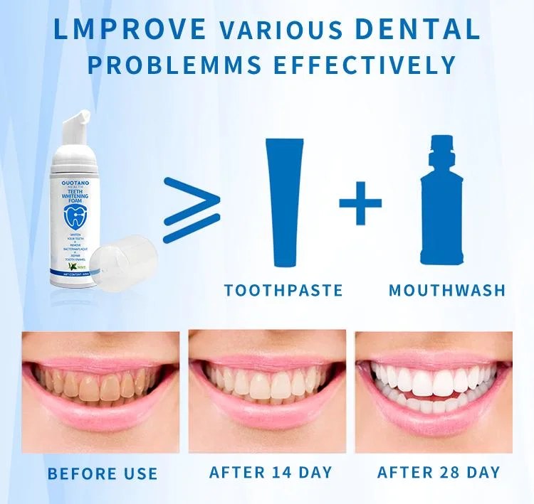Toothpaste Tooth Mousse Cleaning Paste White Private Logo Kit Label Cleansing Teeth Whitening Foam