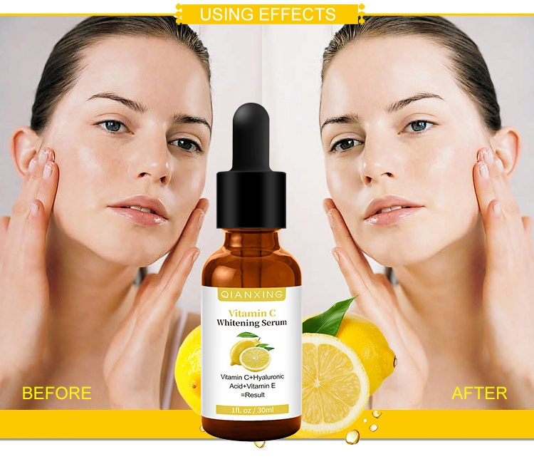 Private Label Skin Care Brightening Hyaluronic Acid Niatinamide Vitamin C Face Serum