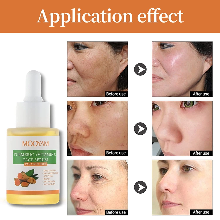 OEM Supplier Beauty Anti Wrinkles Vitamin C Hyaluronic Acid Anti Acne Hydrating Brighten Skin Care Turmeric Face Serum