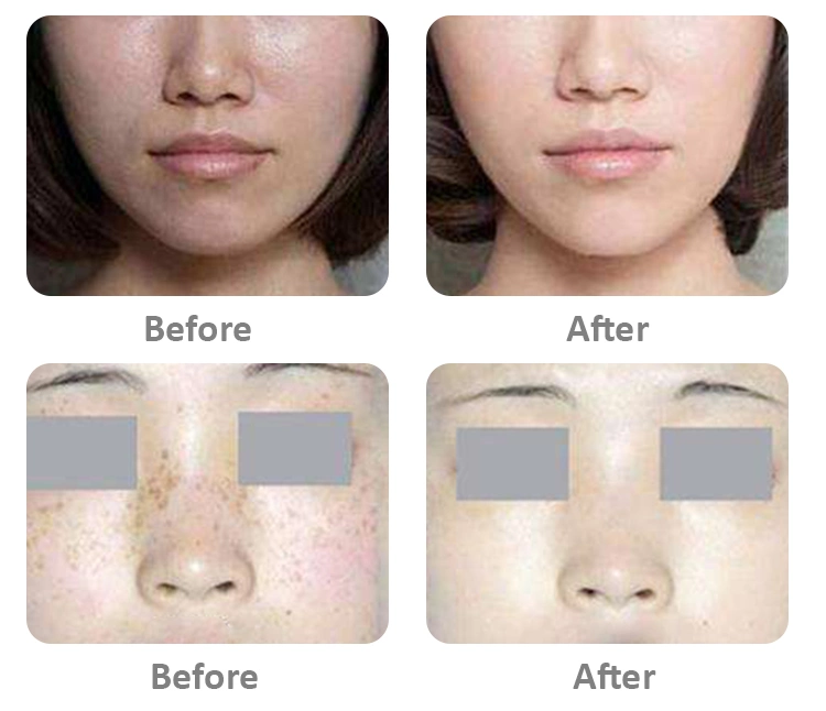 Famous Korea Skin Whitening Injections Brand Luthione Cindella Ascorbic Acid Vitamin C
