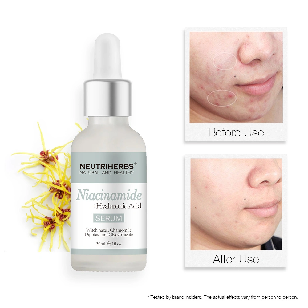 Neutriherbs Cosmetic Best Skin Care Custom Serum Hyaluronic Acid Best Orignal Niacinamide Serum