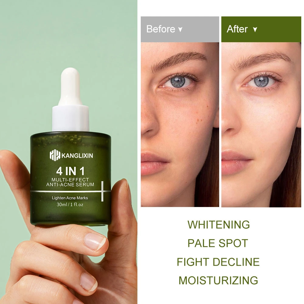 Private Label Skin Care Facial Kale Vitamin C Serum Hydrating Facial Serum with Aloe Vera for Moisturizing Soothes Dry Skin