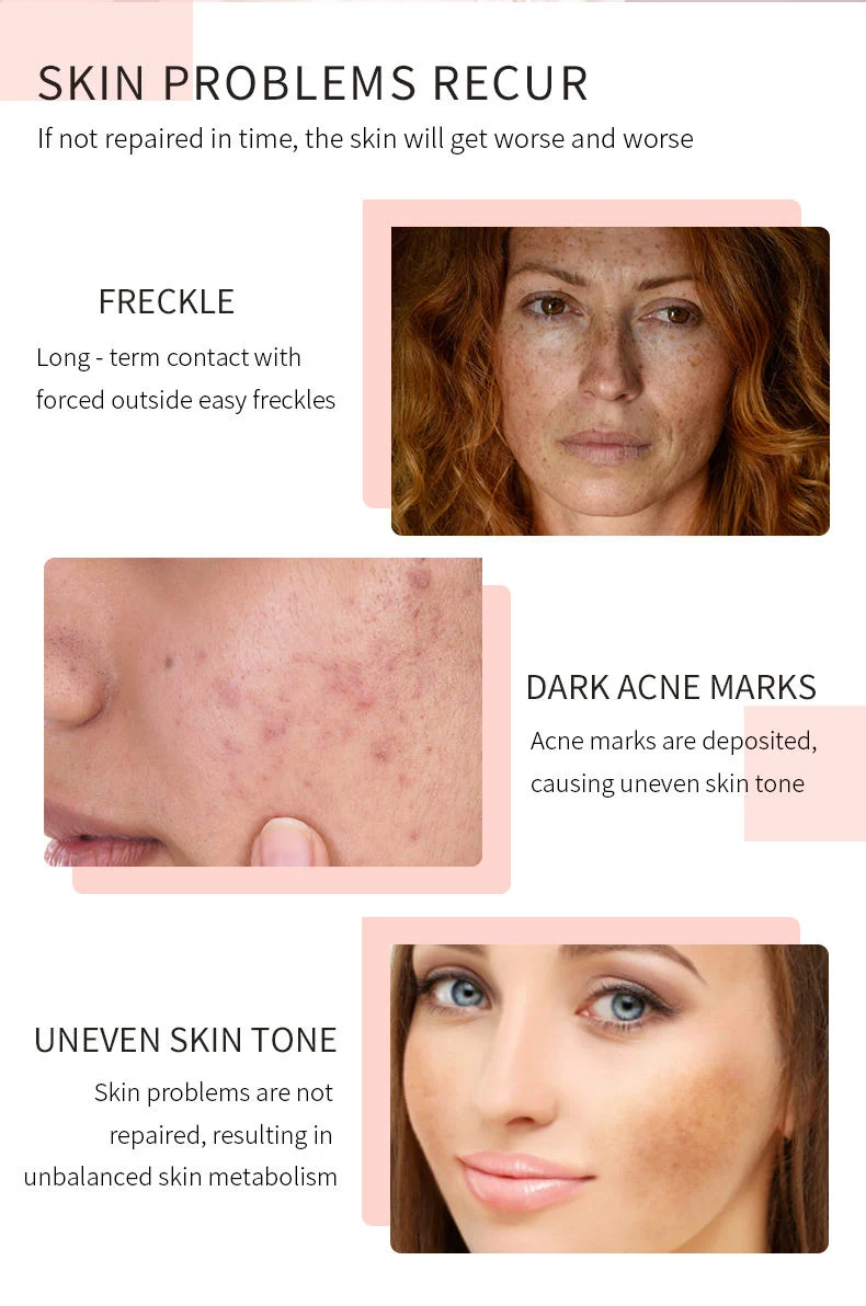Customized Skin Lightening 2% Hydroquinone Remover Spots Corrector Dark Spot Serum