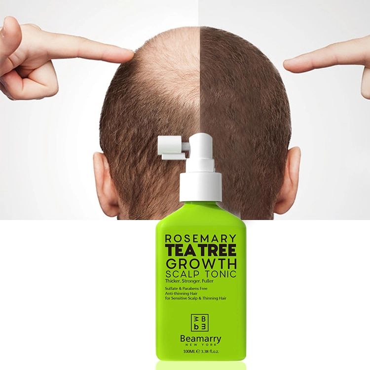 Hair Growth Tonic Hair Tonic Lotion with High Quality Hair Tonic