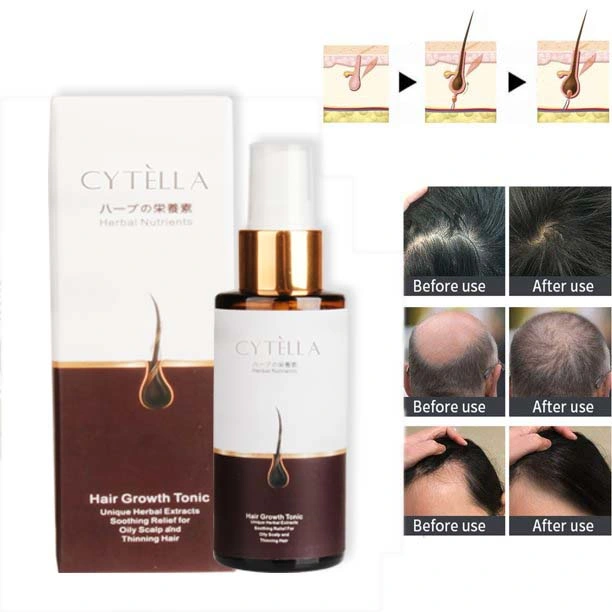 Anti-Hair Loss Follicle Nourish Hair to Protect Hair Growth Tonic