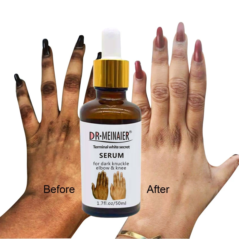 Dark Hand Knuckle Whitening Serum Removing Dark Elbow Knees Clear Dark Knuckles Serum