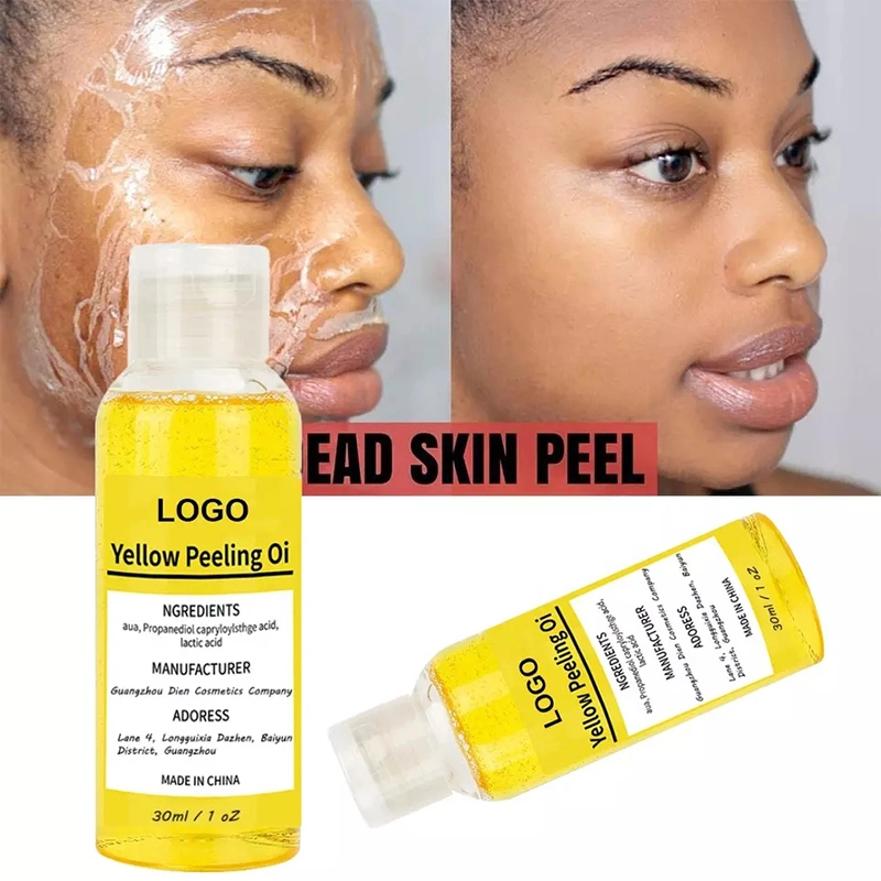 Body Hand Skin Cleansing Exfoliating Whitening Extra Strong Bleaching Dark Skin Private Label Yellow Peeling Oil