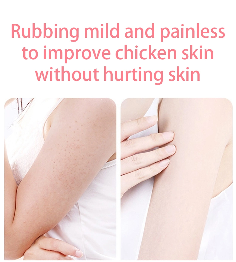 Hot Selling Hydrating Moisturizing Exfoliating Improving Chicken Skin Body Coconut Oil Cream