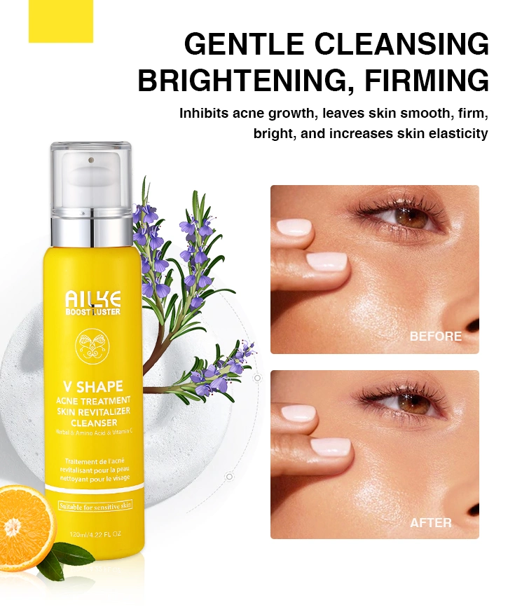 Wholesale Anti Acne Vitamin C Cleanser Whitening Foam Skin Pimples Amino Acid Face Wash for Sensitive Skin
