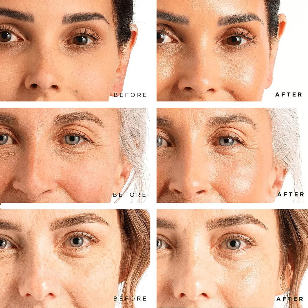 Face Soothing Repair Rejuvenation Anti Wrinkle Private Label Skin Care Brightening Moisturizing Facial Serum