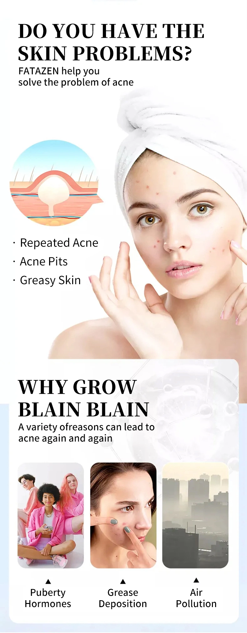 Natural Organic Oil Control Shrinks Pores Woman Skincare Deep Cleansing Acne Cream