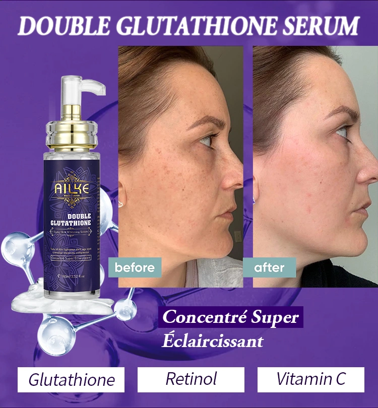 Private Label Ailke Skin Care Set Double-Glutathione Whitening Serum Dark Spot Face Cream Black Skin Soap Bleaching Body Lotion