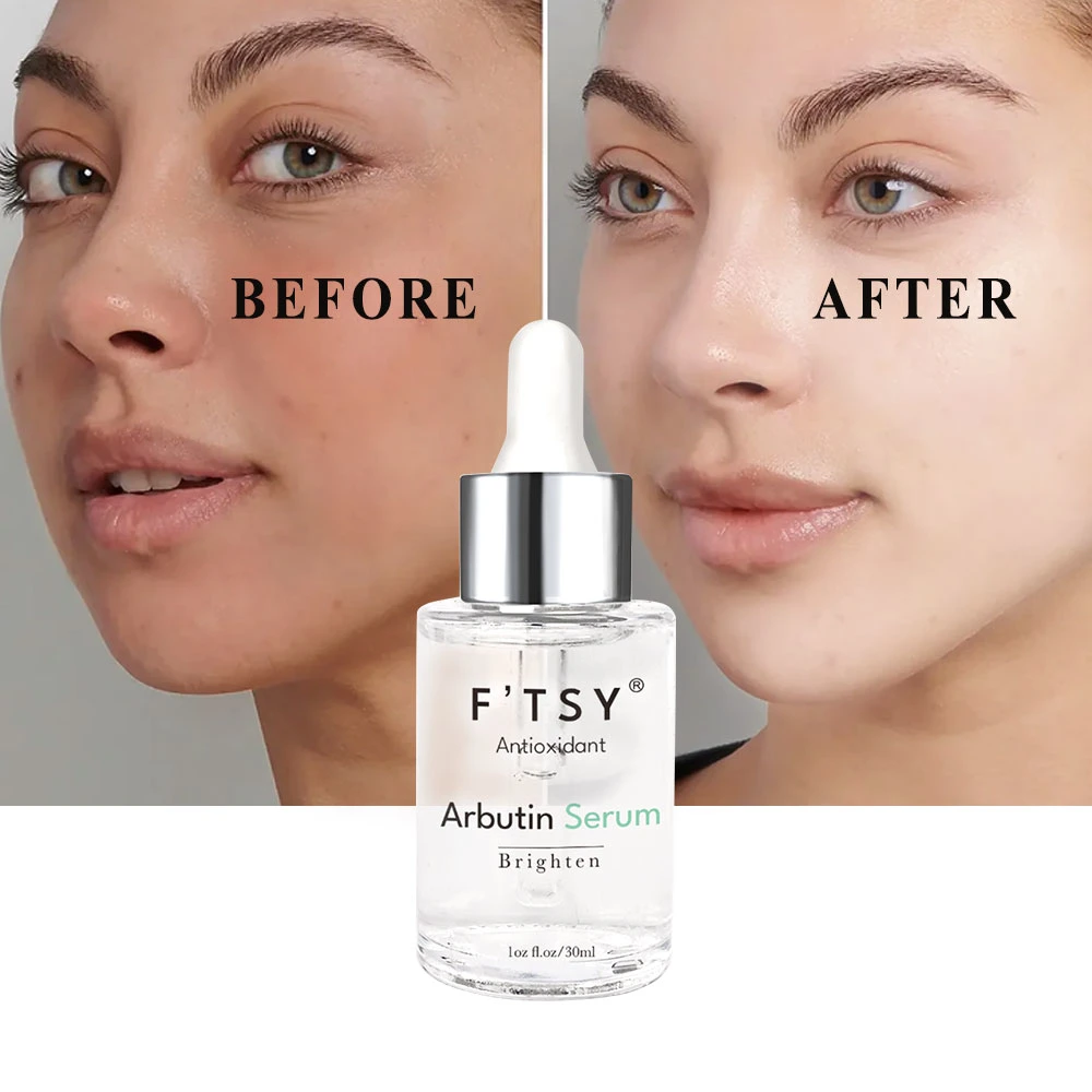 Private Label Natural Whitening Kojic Acid Serum with Arbutin Even Skin Tone Lightening Niacinamide Facial Essence