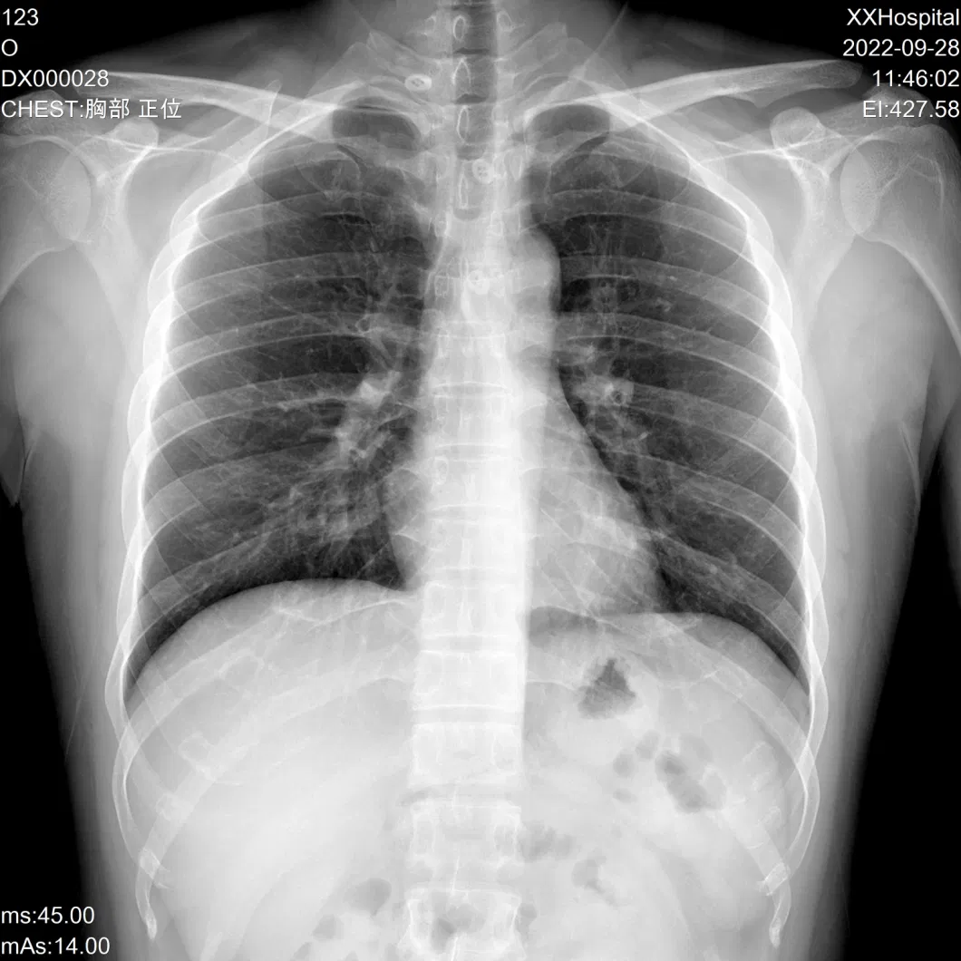 Digital Radiography Dual-Column X-ray Generator