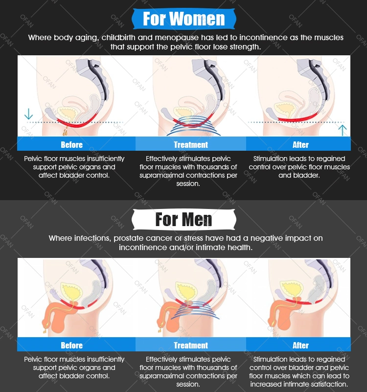 Ofan High-Intensity Focused Electromagnetic Chair for Pelvic Floor Massage Muscles Stimulation Pelvic Floor Chair