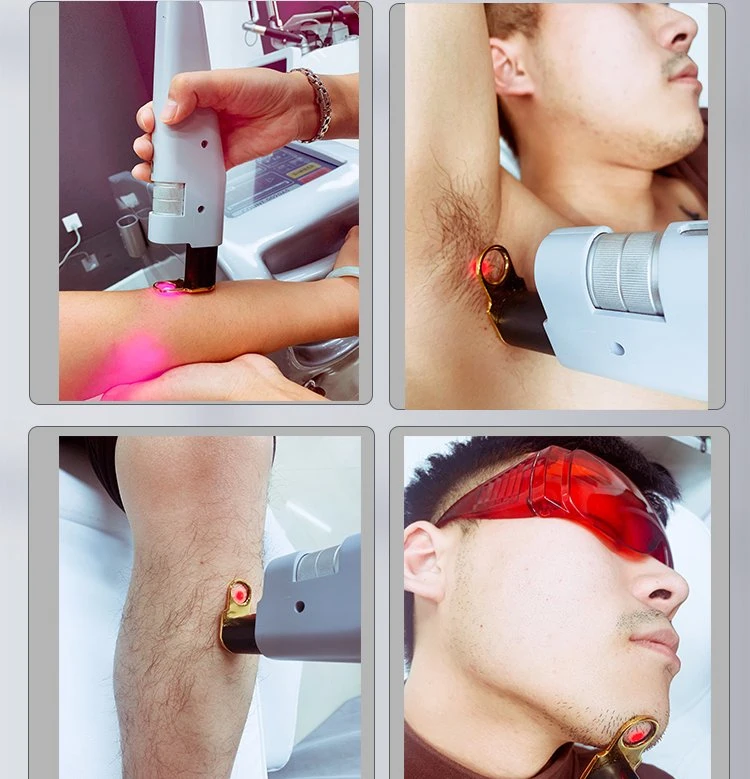 CE Approval Alex Laser 755nm 1064nm ND YAG Skin Cooling Conducted Laser Permanent Hair Removal Alexandrite Laser