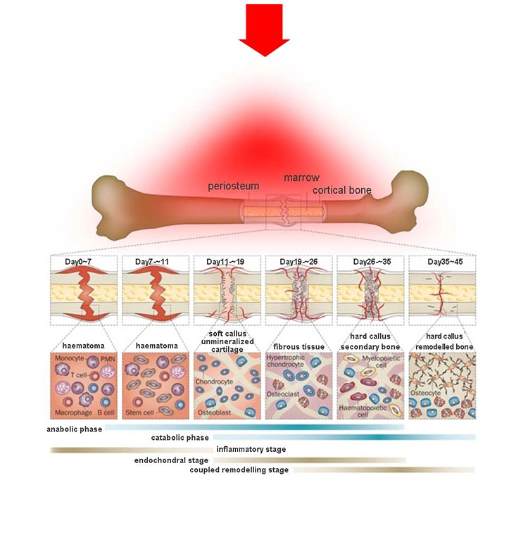 Suyzeko LED Photon Pulse Red Light Therapy Bed for Sports Recovery