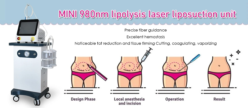 Muscle Spasms Sports Injuries Physiotherapy Liposuction 980+1470nm Laser Machine