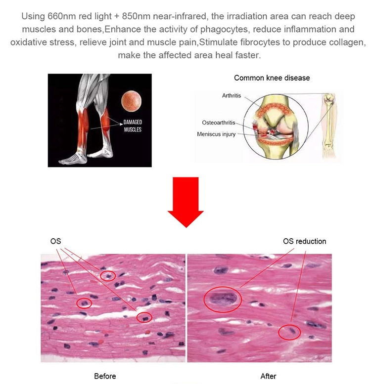 Suyzeko LED Photon Pulse Red Light Therapy Bed for Sports Recovery