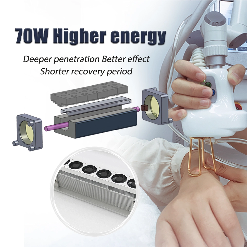 Luminous Glow Fractional Laser Skin Rejuvenation Device