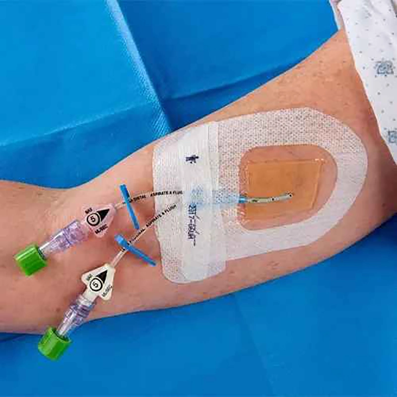 Medical PU Transparent Self-Adhesive IV Cannula Fixing Tape Chg IV Dressing