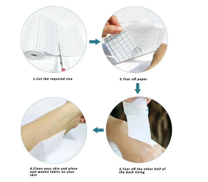 for Wound Care Secures Primary Dressings Medical Dressing Retention Tape Medical Non-Woven Adhesive Roll Plaster