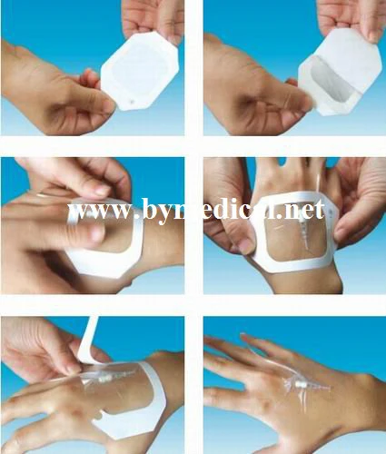 Frame Shape Medical Transparent PU Wound Dressing