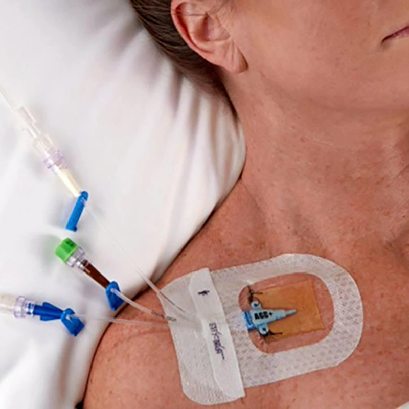 Medical PU Transparent Self-Adhesive IV Cannula Fixing Tape Chg IV Dressing
