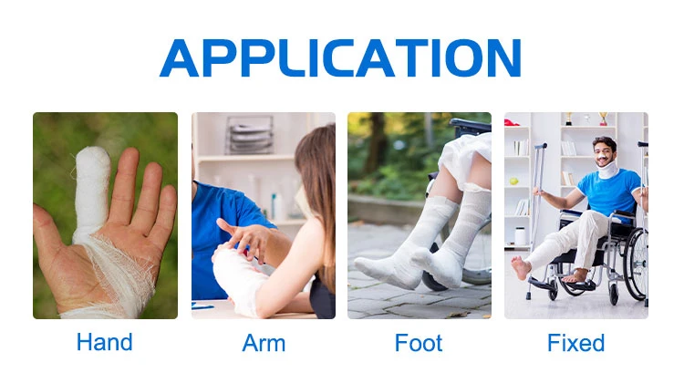 Wholesale Medical Disposables Polyester and Cotton Orthopedic Bandage or Cast Padding