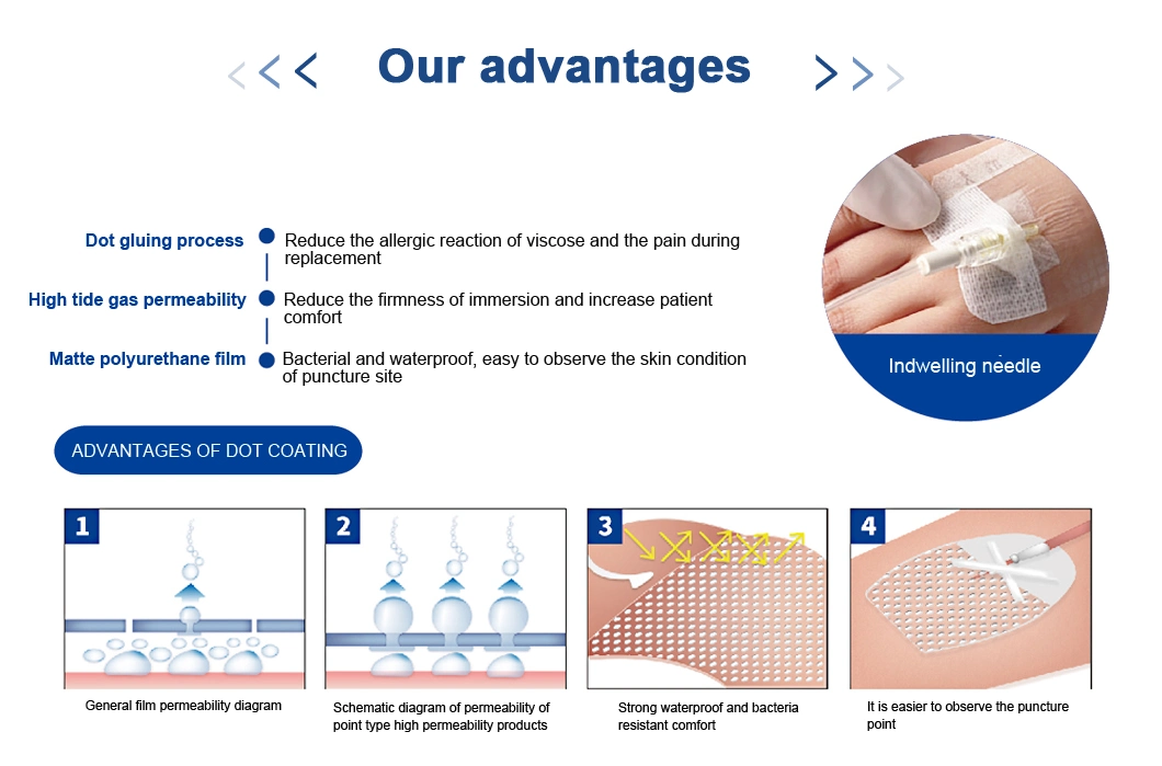 Medical Supply Sterile Disposable Transparent Dressing Plaster for Reduces Mucus Allergy