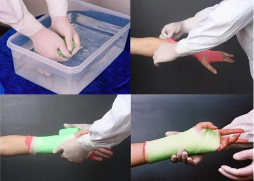 Orthopedic Bandage Medical Plaster Bandage Synthetic Fiberglass Cast