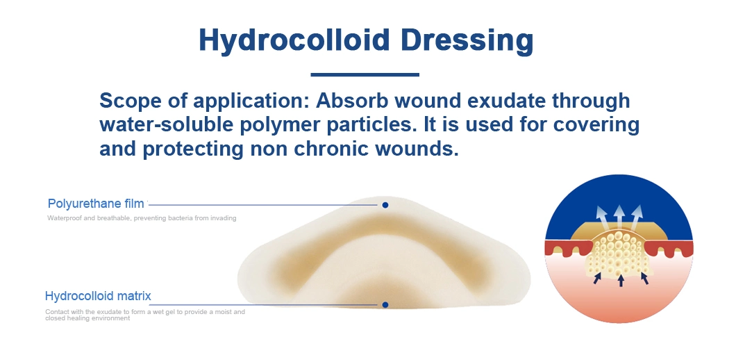 Surgical Hydrocolloid Dressing Medical Plaster for Covering and Protecting Non-Chronic Wounds