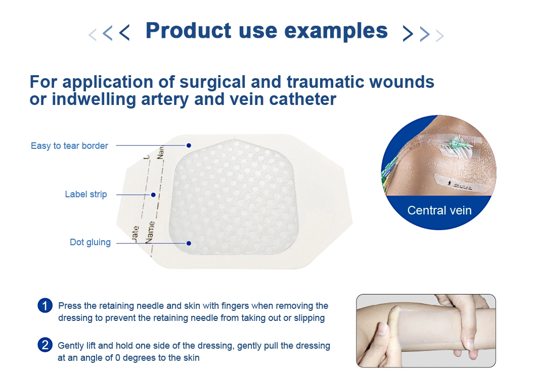 Medical Supply Disposable Transparent Dressing Plaster for Reduces Pain During Replacement