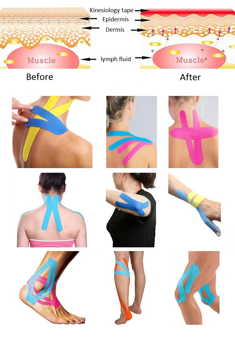 25mm/38mm*5m Kinesio Tape for Sport