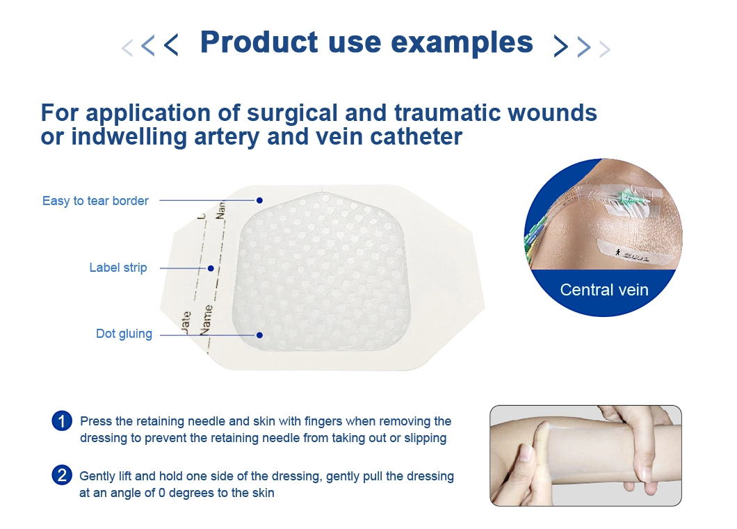 Medical Absorbent Surgical Transparent Wound Dressing Plaster for Traumatic Wound