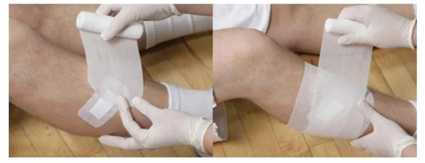 Medical Wound Care Bandage First Aid Emergency Conforming Gauze Bandage Plain Weave PBT Bandages
