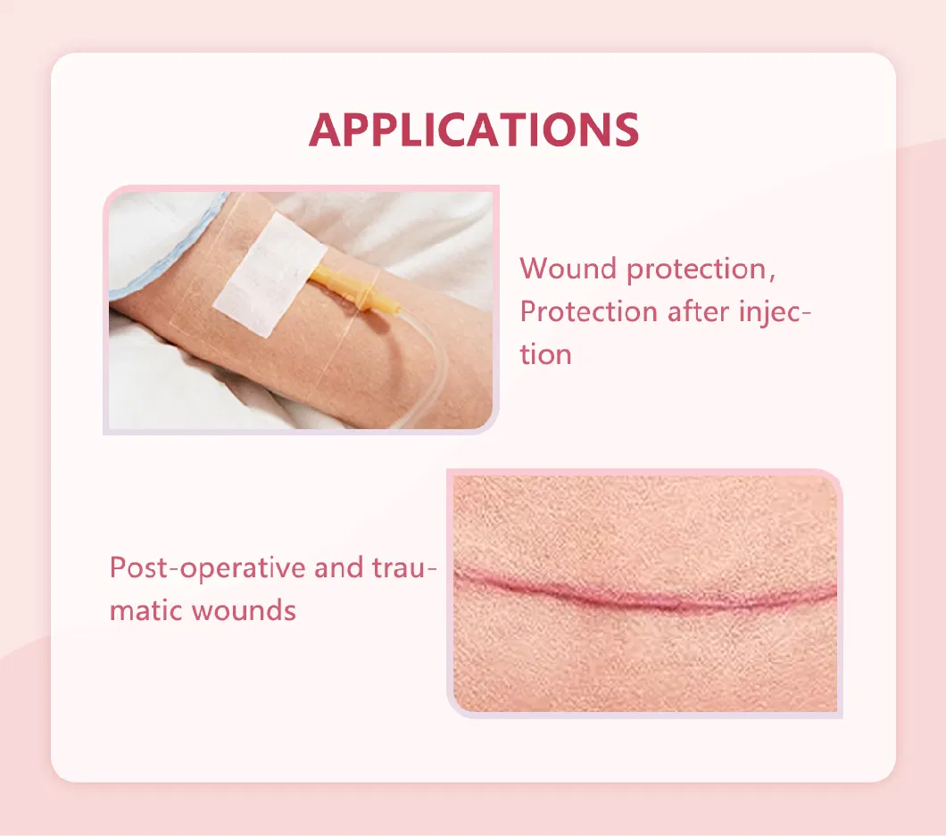 Bluenjoy Medical Supply Waterproof Wound Dressing Adhesive Transparent PU Film Dressing with Pad