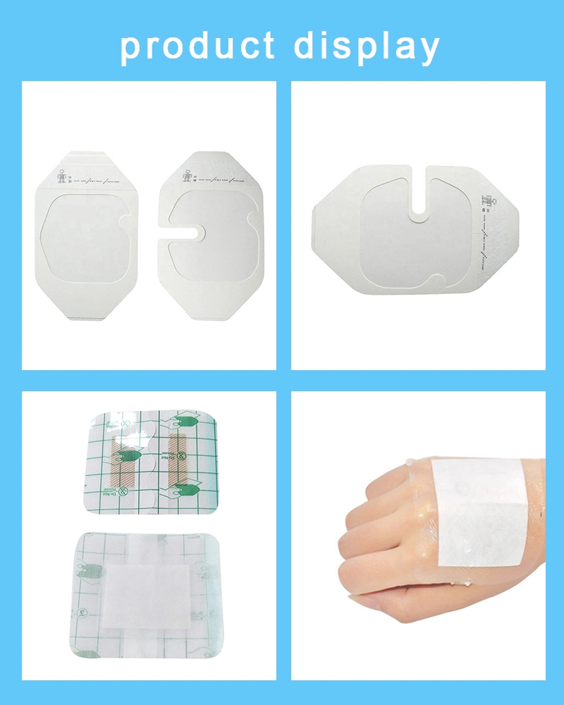 Disposable I. V. Cannula PU Transparent Wound Dressing