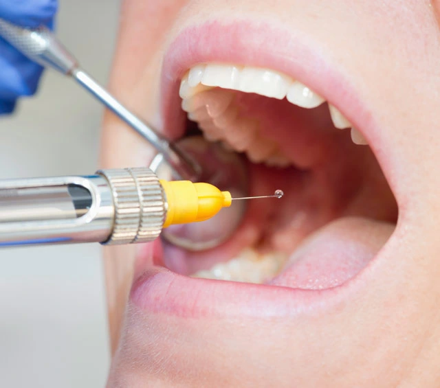 High Quality Original Dental Needle Supply Anaesthesia 27ga 30g Needles for Anesthetize