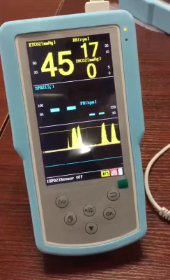 H100 Handheld Etco2 Devices Monitoring SpO2, Pulse Rate, Etco2 and Respiratory Rate Suitable for Clinical and Emergency Circumstance