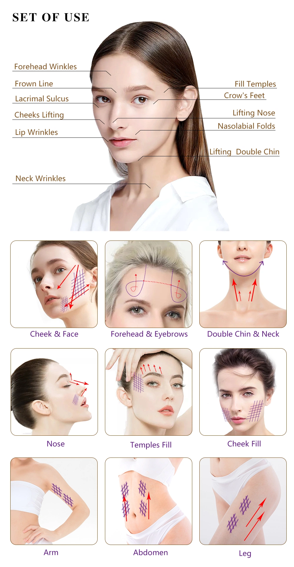 Cosmetic Collagen Mint Pdo Thread Lift Procedure Cost Price Near Me