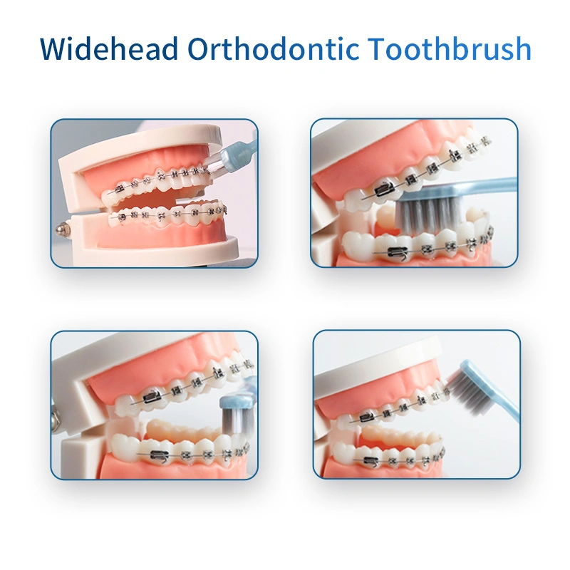 Portable Lollipop Toothbrush with Tongue Scraper V-Shaped Orthodontic Toothbrush