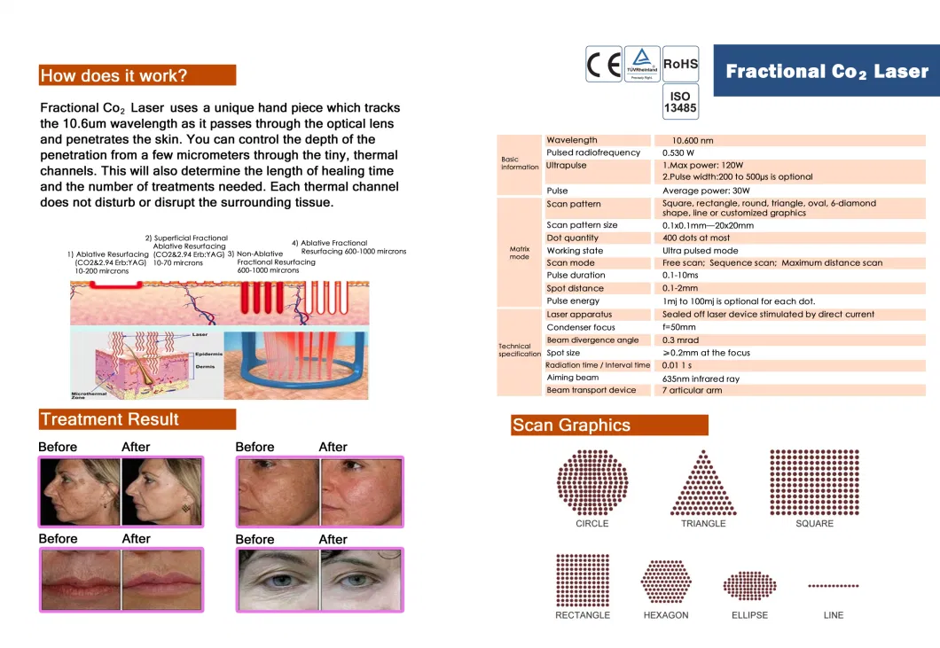 Fractional CO2 Laser Skin Resurfacing Machine New RF CO2 Vaginal Tightening Laser Vaginal Tightening CO2 Fractional Laser Suppliers 15 Years